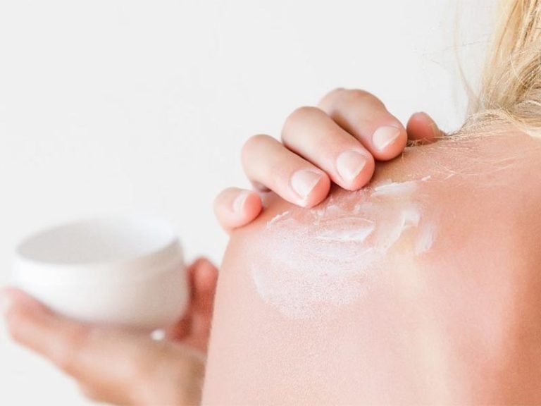 Curare le scottature da sole con rimedi naturali